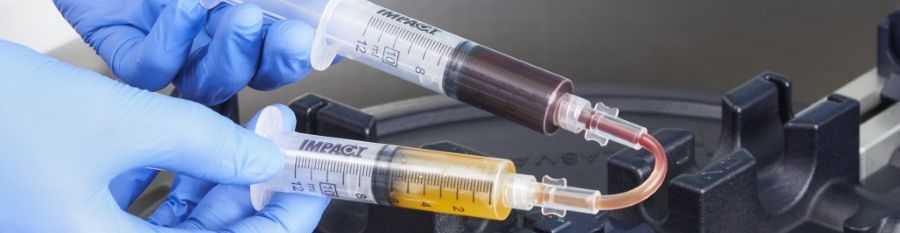 Behandschuhte Hände verbinden zwei Spritzen: oben Eigenblut, unten das aufbereitete gelbliche Plasma